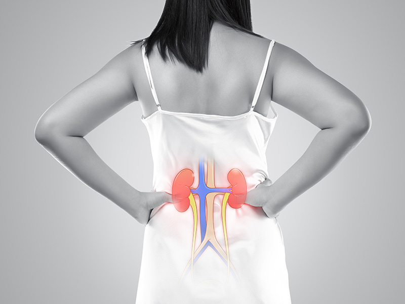 Chronic-Kidney-Disease-2