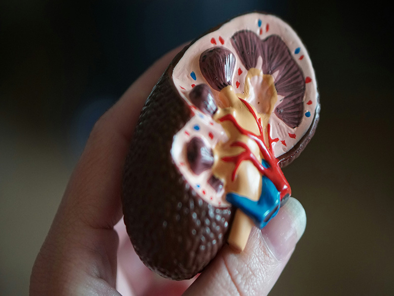 Five-Stages-of-Chronic-Kidney-Disease-2